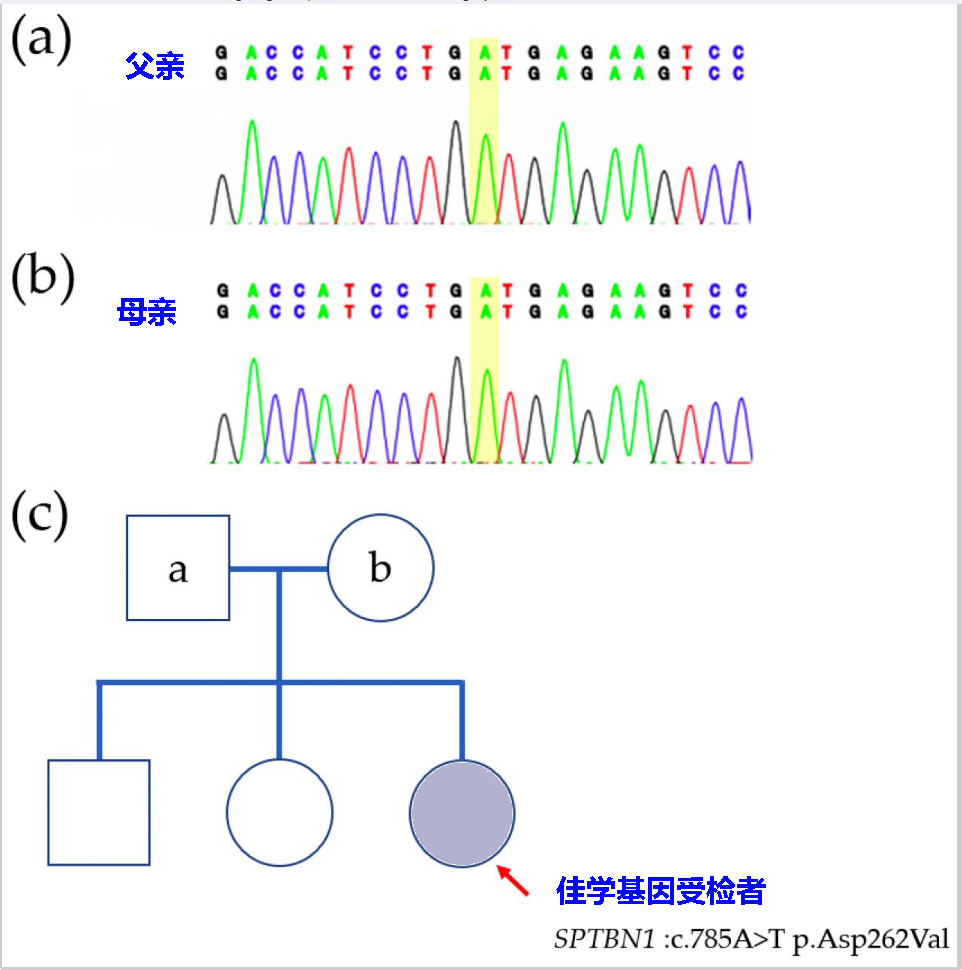 【Ebpay(中国)基因检测】婴儿<font color='red'>癫痫</font>痉挛综合征基因检测病例